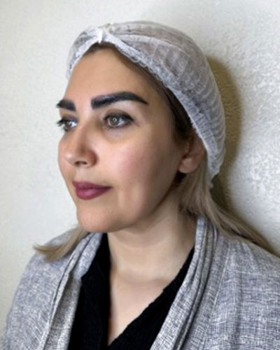 بازطراحی فرم صورت