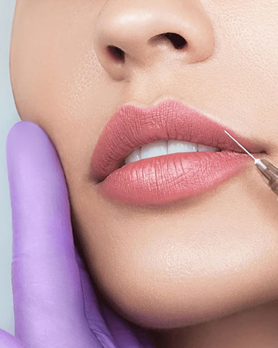 فیلرهای پوستی|آفامد|شرکت آفامد