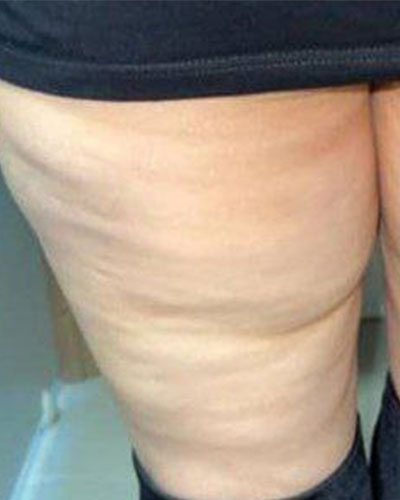 بازاسازی بافت پوستی